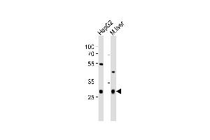 Western blot analysis of lysates from HepG2 cell line, mouse liver tissue lysate (from left to right), using CTDSP1 Antibody (N-term) (ABIN6243354 and ABIN6577527). (CTDSP1 抗体  (N-Term))