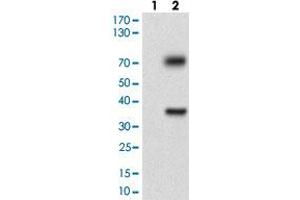 Western blot analysis of Lane 1: Negative control [HEK293 cell lysate]; Lane 2: Over-expression lysate [TUBE1 (AA: 314-472)-hIgGFc transfected HEK293 cells] with TUBE1 monoclonal antibody, clone 7G3B2  at 1:500-1:2000 dilution. (TUBE1 抗体  (AA 314-472))