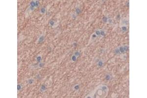 IHC-P analysis of Human Tissue, with DAB staining. (GRIP1 抗体  (AA 79-268))