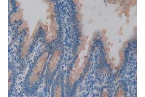 DAB staining on IHC-P; Samples: Rat Intestine Tissue