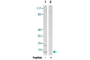 Western blot analysis of extracts from HepG2 cells, using MRPS16 polyclonal antibody . (MRPS16 抗体)
