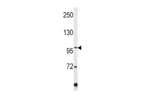 Western blot analysis of COL6A1 antibody (C-term) (ABIN390513 and ABIN2840867) in Y79 cell line lysates (35 μg/lane). (COL6A1 抗体  (C-Term))