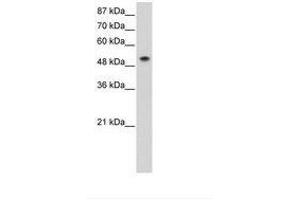 Image no. 1 for anti-Small Nuclear Ribonucleoprotein 70kDa (U1) (SNRNP70) (AA 91-140) antibody (ABIN6736251) (SNRNP70 抗体  (AA 91-140))