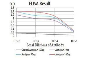 Black line: Control Antigen (100 ng),Purple line: Antigen (10 ng), Blue line: Antigen (50 ng), Red line:Antigen (100 ng) (GRM7 抗体  (AA 454-590))