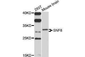 Western blot analysis of extracts of 293T and mouse brain cells, using SNF8 antibody. (SNF8 抗体)