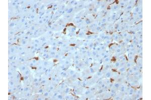 Formalin-fixed, paraffin-embedded human Liver stained with C1QA Mouse Monoclonal Antibody (C1QA/2953). (C1QA 抗体  (AA 104-237))