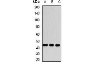 Western blot analysis of Dnmt3L expression in PC3 (A), Jurkat (B), MCF7 (C) whole cell lysates. (DNMT3L 抗体)