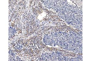 IHC analysis of GFPT1 using anti-GFPT1 antibody (ABIN7602887). (GFPT1 抗体  (C-Term))