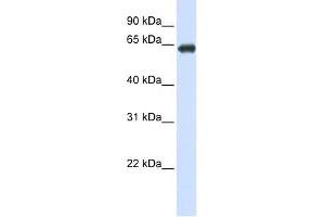 SLC39A4 antibody used at 1 ug/ml to detect target protein. (SLC39A4 抗体)