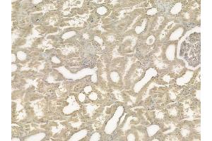 ABIN6258467 and ABIN6275239 at 1/100 staining human normal kidney tissue by IHC-P.