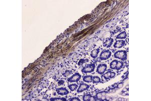 IHC analysis of MYLK using anti-MYLK antibody . (MYLK 抗体  (AA 1441-1709))