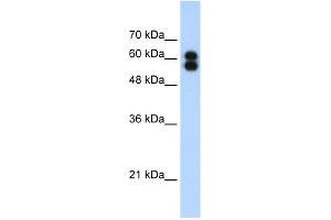 ALPP antibody used at 1. (PLAP 抗体)
