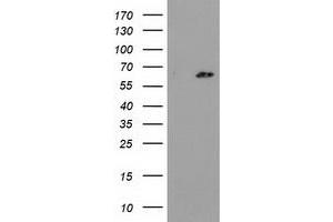 Western Blotting (WB) image for anti-Glucokinase (Hexokinase 4) Regulator (GCKR) antibody (ABIN1498414) (GCKR 抗体)
