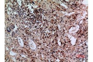 Immunohistochemistry (IHC) image for anti-Solute Carrier Family 10 (Sodium/bile Acid Cotransporter Family), Member 1 (SLC10A1) (C-Term) antibody (ABIN3187880)