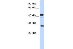 WB Suggested Anti-CDCA5 Antibody Titration: 0. (CDCA5 抗体  (Middle Region))