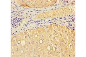 Immunohistochemistry of paraffin-embedded human liver tissue using ABIN7175549 at dilution of 1:100 (VMO1 抗体  (AA 25-202))