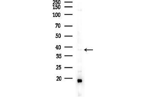 anti-Ras Association (RalGDS/AF-6) Domain Family Member 1 (RASSF1) (Internal Region) antibody