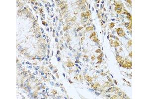 Immunohistochemistry of paraffin-embedded Human stomach using RNASE13 Polyclonal Antibody at dilution of 1:100 (40x lens). (RNASE13 抗体)