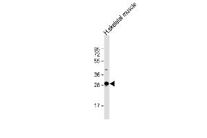 Anti-DNASE1L2 Antibody (C-Term) at 1:2000 dilution + human skeletal muscle lysate Lysates/proteins at 20 μg per lane. (DNASE1L2 抗体  (AA 199-229))
