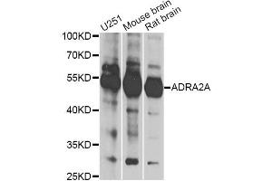 Western blot analysis of extracts of various cell lines, using ADRA2A antibody (ABIN6291251) at 1:1000 dilution. (ADRA2A 抗体)