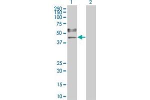 Lane 1: TNFRSF11B transfected lysate ( 46 KDa).