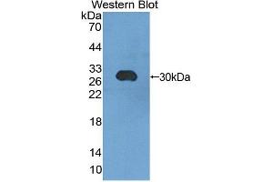Western blot analysis of the recombinant protein. (CHGB 抗体  (AA 448-664))