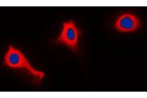 Immunofluorescent analysis of p47 phox (pS370) staining in THP1 cells. (NCF1 抗体  (C-Term, pSer370))