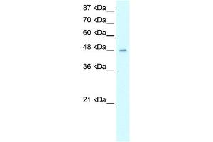 WB Suggested Anti-HMG20A Antibody Titration:  0. (HMG20A 抗体  (Middle Region))