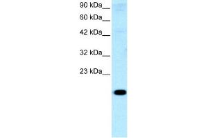 WB Suggested Anti-CITED1 Antibody Titration:  0. (CITED1 抗体  (Middle Region))