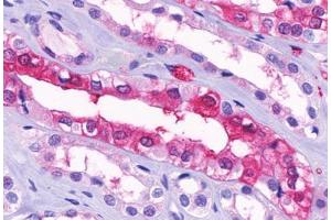 Anti-GPR91 antibody  ABIN1048899 IHC staining of human kidney, medulla. (SUCNR1 抗体  (Cytoplasmic Domain))