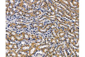 ABIN7096909 and ABIN7100975 at 1/100 staining mouse kidney tissue by IHC-P. (Clavesin 1 抗体)