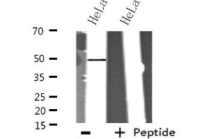 Western blot analysis of extracts from HeLa cells using ITPK1 antibody. (ITPK1 抗体  (Internal Region))