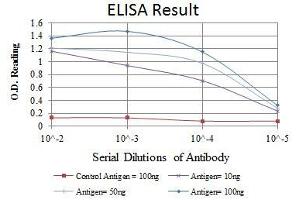 Red: Control Antigen (100 ng), Purple: Antigen (10 ng), Green: Antigen (50 ng), Blue: Antigen (100 ng), (MSX1 抗体)