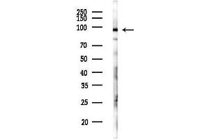 Western blot analysis of lysates from HepG2 cells(LPS,4h treatment), using WDR70 Antibody at 1/1000 dilution. (WDR70 抗体)