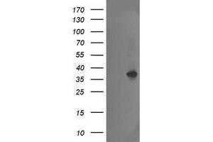 Western Blotting (WB) image for anti-Nudix (Nucleoside Diphosphate Linked Moiety X)-Type Motif 18 (NUDT18) antibody (ABIN1499858) (NUDT18 抗体)