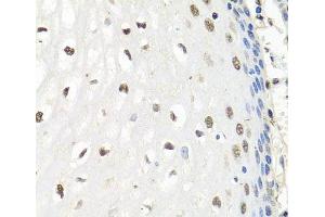 Immunohistochemistry of paraffin-embedded Human esophagus using CNOT8 Polyclonal Antibody at dilution of 1:100 (40x lens). (CNOT8 抗体)