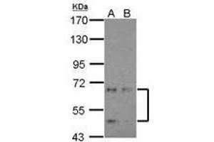 Image no. 1 for anti-Cyclin-Dependent Kinase-Like 3 (CDKL3) (AA 46-308) antibody (ABIN1497433) (CDKL3 抗体  (AA 46-308))