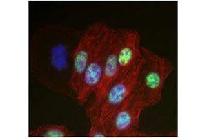 Immunofluorescence (IF) image for anti-DEAD (Asp-Glu-Ala-Asp) Box Polypeptide 5 (DDX5) antibody (ABIN2664927) (DDX5 抗体)