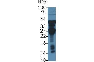 Western Blotting (WB) image for anti-Ornithine Carbamoyltransferase (OTC) (AA 78-129) antibody (ABIN7433690)