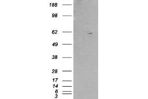 Western Blotting (WB) image for anti-Retinoid X Receptor, beta (RXRB) antibody (ABIN5876651) (Retinoid X Receptor beta 抗体)