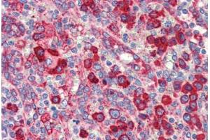 Human Spleen (formalin-fixed, paraffin-embedded) stained with HSP90B1 antibody ABIN462106 at 10 ug/ml followed by biotinylated secondary antibody, alkaline phosphatase-streptavidin and chromogen. (GRP94 抗体)