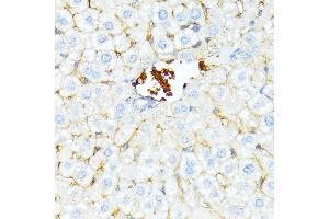 Immunohistochemistry of paraffin-embedded mouse liver using alpha 1 Spectrin antibody (ABIN6129333, ABIN6148401, ABIN6148402 and ABIN6215956) at dilution of 1:100 (40x lens). (SPTA1 抗体  (AA 940-1160))