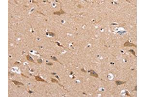The image on the left is immunohistochemistry of paraffin-embedded Human brain tissue using ABIN7130278(MSMB Antibody) at dilution 1/30, on the right is treated with fusion protein. (MSMB 抗体)