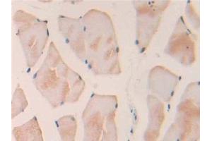 Detection of IL18 in Rat Skeletal muscle Tissue using Polyclonal Antibody to Interleukin 18 (IL18) (IL-18 抗体  (AA 37-194))