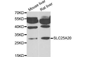 Western blot analysis of extracts of various cell lines, using SLC25A20 antibody (ABIN5974144) at 1/1000 dilution. (SLC25A20 抗体)