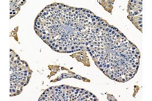 anti-Dmx-Like 1 (DMXL1) antibody