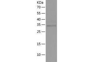 Western Blotting (WB) image for Serine Dehydratase-Like (SDSL) (AA 1-329) protein (His tag) (ABIN7288358) (SDSL Protein (AA 1-329) (His tag))