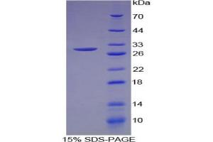 SDS-PAGE analysis of Human MEPE Protein. (MEPE 蛋白)