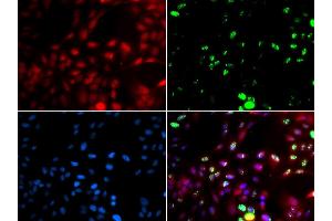 Immunofluorescence analysis of GFP-RNF168 transgenic U2OS cells using POLK antibody (ABIN5973607). (POLK 抗体)