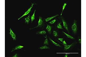 Immunofluorescence of purified MaxPab antibody to DAXX on HeLa cell. (DAXX 抗体  (AA 1-740))